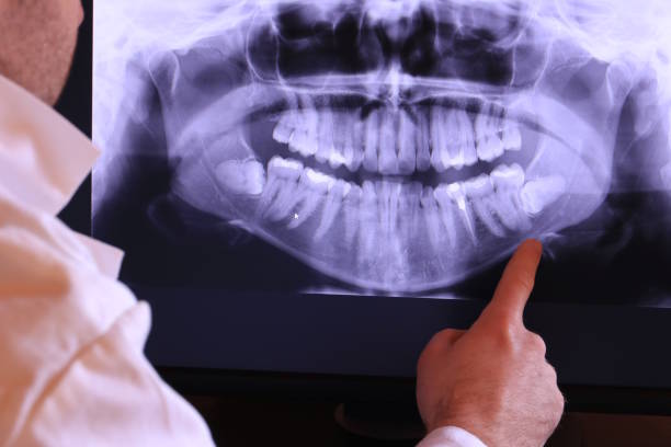 Best Emergency Dental Surgery in Ada, OK