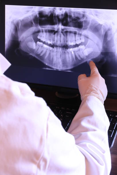 Best Emergency Wisdom Teeth Removal in Ada, OK
